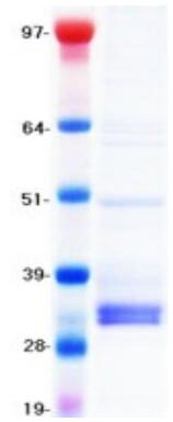 Coomassie blue staining of purified TIGIT protein.